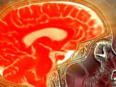 Почему трата денег действует как наркотик - Наука и здоровье