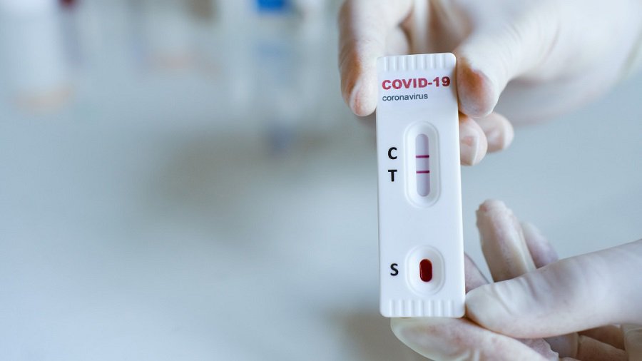 Дорабатывается процедура самотестирования, когда люди смогут покупать тесты в аптеке - Литва и страны Балтии