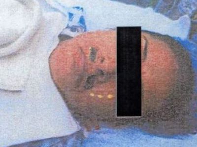 Врач поглумился над пациенткой во время операции - В Мире