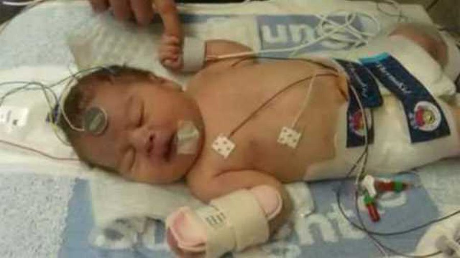 Врачи заморозили новорожденного, чтобы спасти ему жизнь - Наука и здоровье