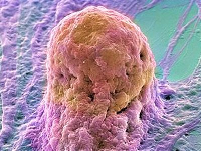 Выращивание органов с помощью стволовых клеток может стать реальностью
 - Наука и здоровье