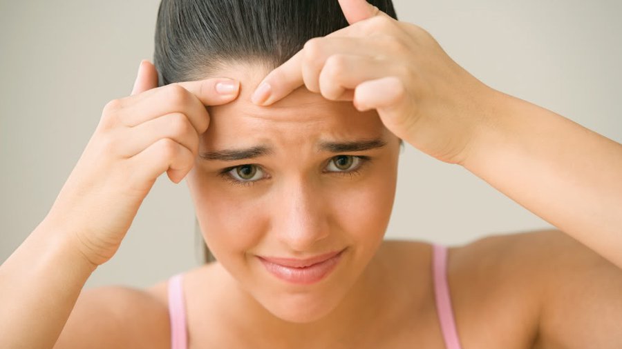 Проблемная кожа: как бороться с прыщами? - Наука и здоровье