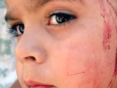 Трудное детство вызывает мутации в генах - Наука и здоровье