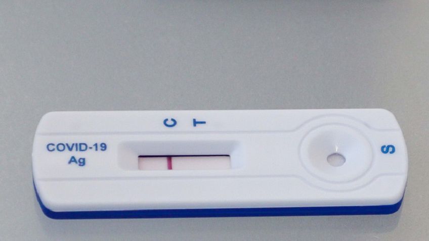 Keli prekybos tinklai jau pradėjo prekybą greitaisiais antigeno testais, kiti dar vertina galimybes