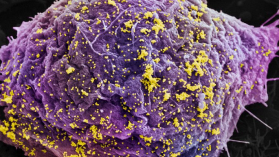 ВИЧ можно победить с помощью механизма репликации ДНК - Наука и здоровье