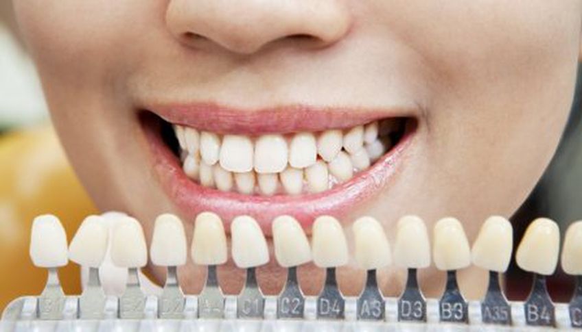 Привычки, которые разрушают наши зубы