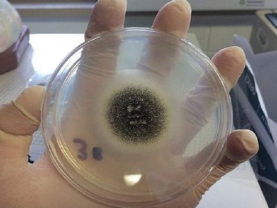 В Египте выявили семь случаев "черной плесени" - Наука и здоровье