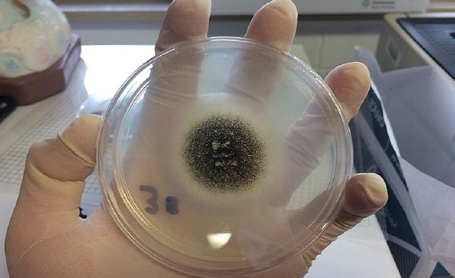 В Египте выявили семь случаев "черной плесени" - Наука и здоровье