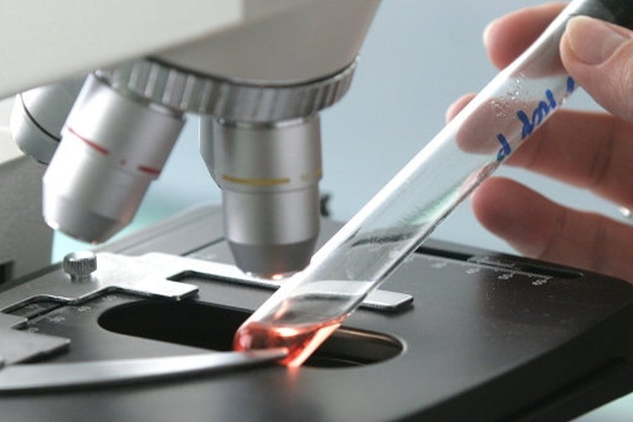 Поразившую европейцев кишечную инфекцию связали с семенами из Египта
                 - Наука и здоровье