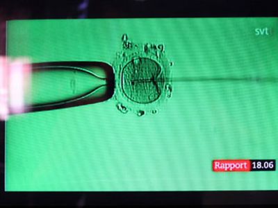 Латвия легализует импорт спермы - Литва и страны Балтии