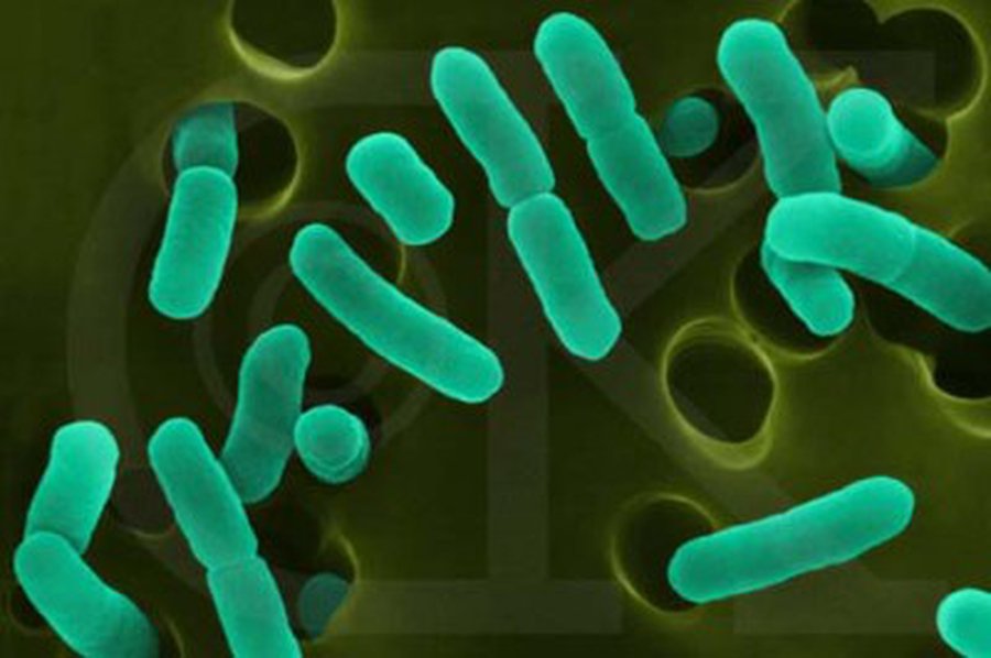 Tailandas europietiškuose avokaduose rado E. coli bakterijų                 - Pasaulyje