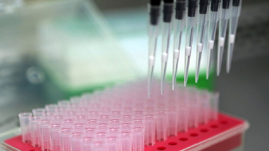 В Швейцарии разработали методику диагностики травмы мозга по капле крови - Наука и здоровье