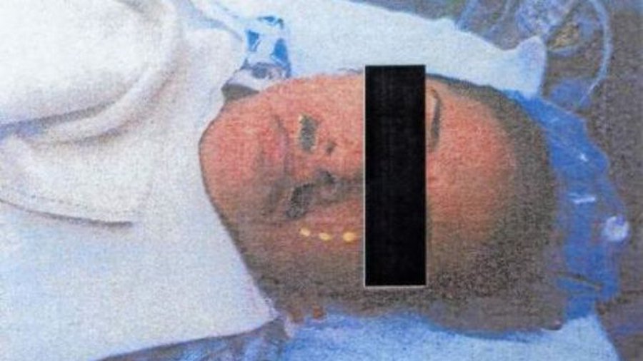 Врач поглумился над пациенткой во время операции - В Мире