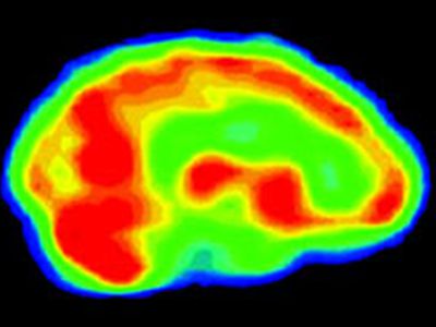 Мозг геев и лесбиянок работает по модели противоположного пола - Наука и здоровье