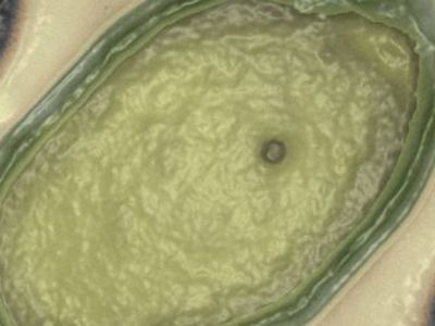 Susipažinkite – didžiausias pasaulyje virusas - Pasaulyje