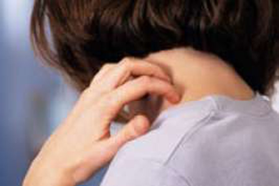 Стресс вызывает зуд - Наука и здоровье