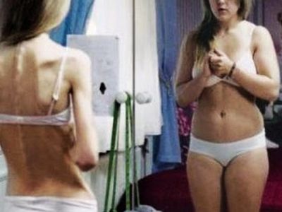 Анорексия и булимия преследуют и убивают женщин - Наука и здоровье