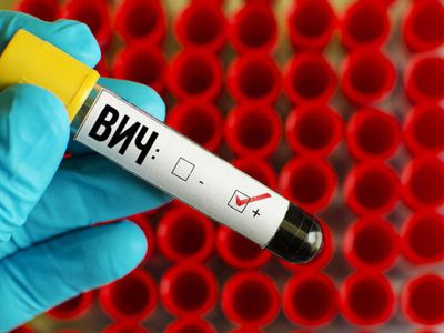 Учёные создали иммунные клетки, способные дать отпор ВИЧ - Наука и здоровье