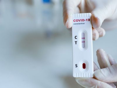 Дорабатывается процедура самотестирования, когда люди смогут покупать тесты в аптеке - Литва и страны Балтии