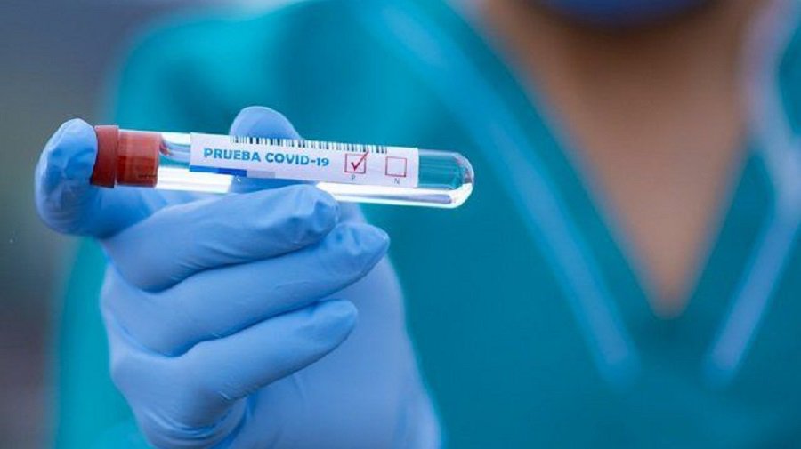 VPSPC проводит платные  ПЦР‑тесты на COVID‑19 - В Висагинасе