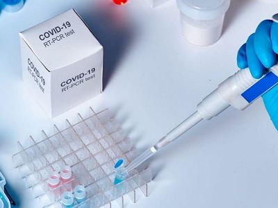 Зарегистрироваться на тестирование COVID-19 можно по интернету - В Висагинасе