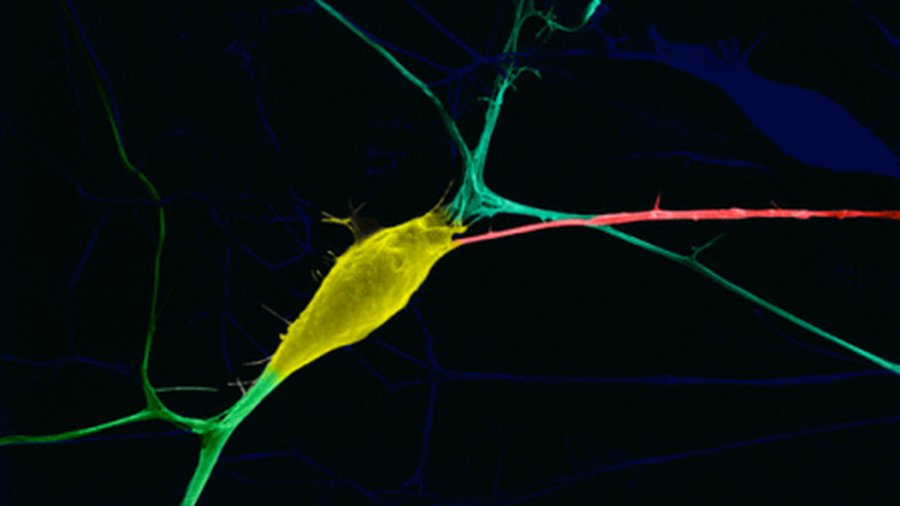 Думать — вредно, или Как мышление ухудшает ДНК - Наука и здоровье
