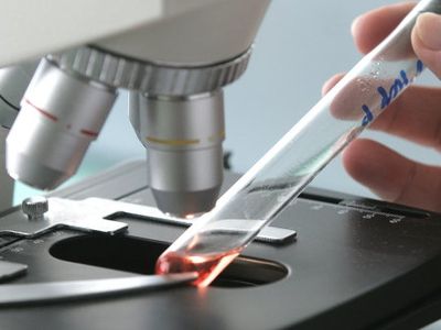 Поразившую европейцев кишечную инфекцию связали с семенами из Египта
                 - Наука и здоровье