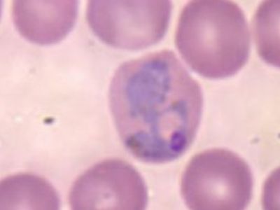 В Литве появилась малярия - Наука и здоровье