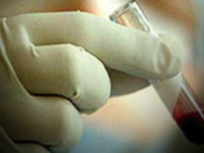 СПИД, болезнь Альцгеймера и простуда лидируют в рейтинге самых загадочных заболеваний мира - Наука и здоровье