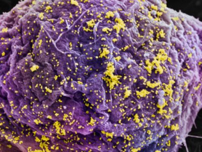 ВИЧ можно победить с помощью механизма репликации ДНК - Наука и здоровье