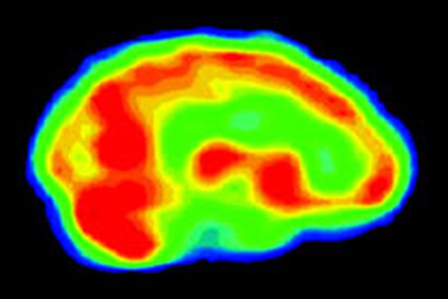 Мозг геев и лесбиянок работает по модели противоположного пола - Наука и здоровье