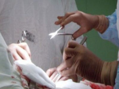 Хирург-наркоман украл из желудка пациента героин - Происшествия и криминал