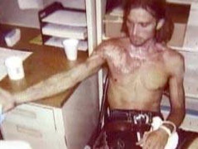 Американские полицейские подожгли бездомного - Происшествия и криминал