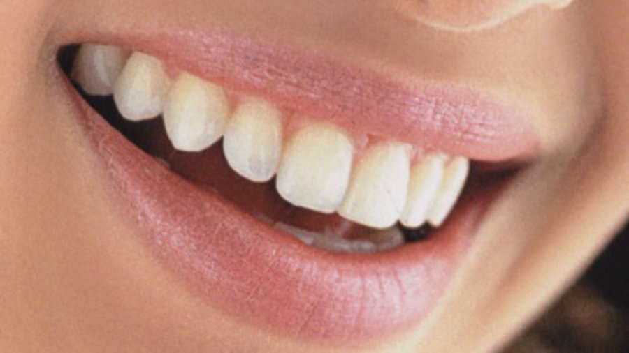 Японцы придумали искусственную зубную эмаль - Наука и здоровье