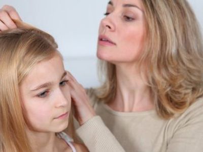 Вильнюсские школы и детсады атакуют вши - Наука и здоровье