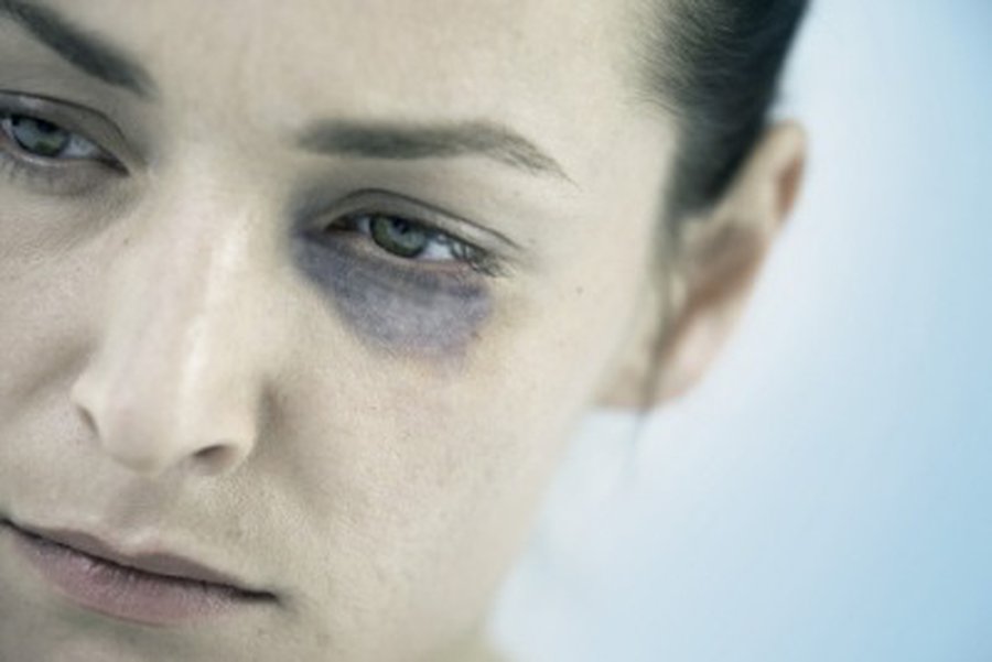 Visagino miesto akcija „16 dienų prieš smurtą prieš moteris“ - Visagine