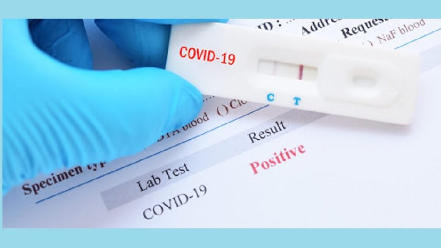 Как проходит тестирование висагинских школьников на COVID-19? - В Висагинасе