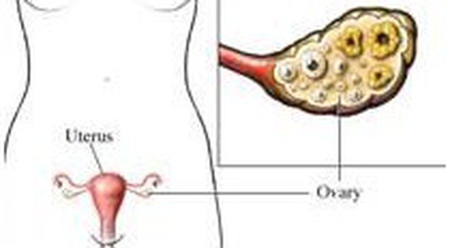 Испанка забеременела после пересадки «замороженной» ткани яичника - Наука и здоровье