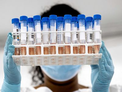 Имеющиеся данные не обнадеживают: в Литве есть около 20 активных очагов коронавируса - Литва и страны Балтии