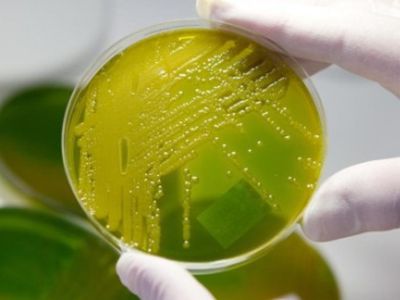 Mirtinas E. coli protrūkis Vokietijoje baigėsi - Pasaulyje