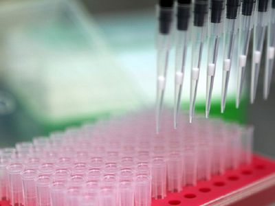 В Швейцарии разработали методику диагностики травмы мозга по капле крови - Наука и здоровье