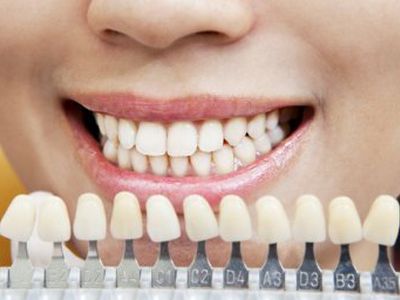 Привычки, которые разрушают наши зубы - Наука и здоровье