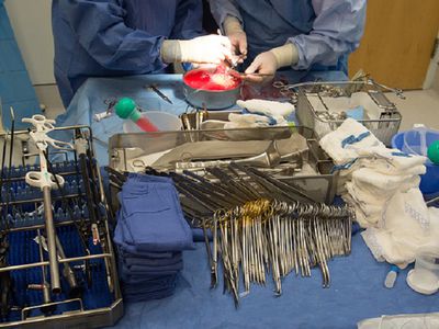 Guardian: британский хирург лазером выжигал свои инициалы на печени пациентов - Происшествия и криминал