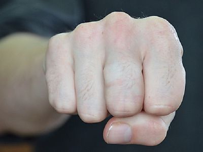 Поцарапанный нос – результат выяснения отношений работодателя с работником - Происшествия и криминал