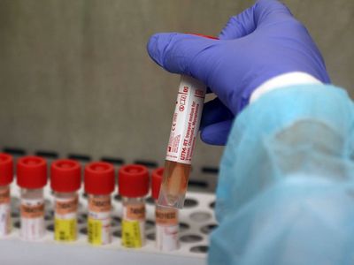 Начинается сероэпидемиологическое исследование жителей Литвы - Литва и страны Балтии