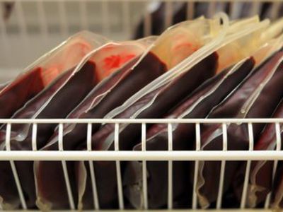 У донора перелитой пациентам крови позднее диагностировали ВИЧ - Наука и здоровье