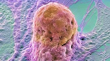 Выращивание органов с помощью стволовых клеток может стать реальностью
