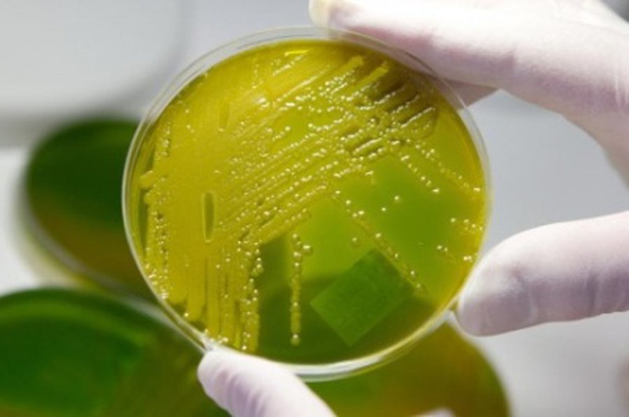 Mirtinas E. coli protrūkis Vokietijoje baigėsi - Pasaulyje