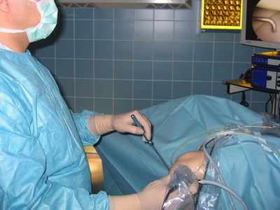 В Республиканской шяуляйской больнице  проведена уникальная операция - Литва и страны Балтии