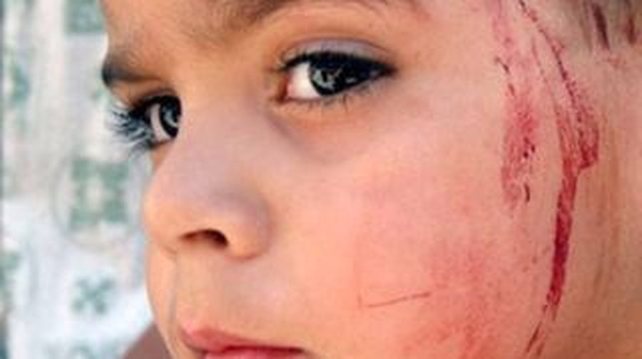 Трудное детство вызывает мутации в генах - Наука и здоровье